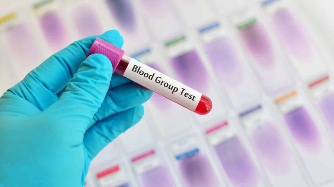 blood-group-test