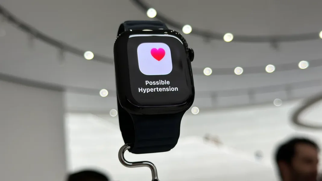 Apple watch