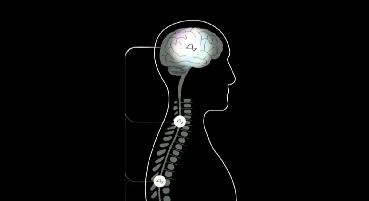 Samsung will make next-generation Neuralink brain chip
