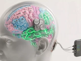 China beats Neuralink with world’s first commercial brain chip implant