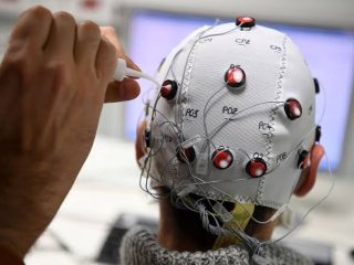 China implants 1st commercial BCI with Neuracle device in patient